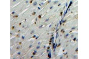 Immunohistochemistry (IHC) image for anti-Nuclear Receptor Subfamily 3, Group C, Member 1 (Glucocorticoid Receptor) (NR3C1) (AA 532-730) antibody (ABIN1860047)