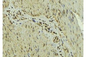 ABIN6277139 at 1/100 staining Mouse muscle tissue by IHC-P. (MAX 抗体  (N-Term))
