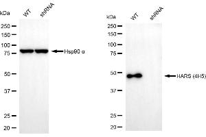 Western blotting analysis using HARS1 antibody (ABIN7798918). (Histidine--tRNA Ligase (HARS-1) 抗体)