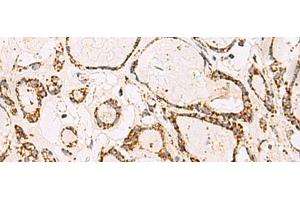 Immunohistochemistry (Paraffin-embedded Sections) (IHC (p)) image for anti-ATP Synthase, H+ Transporting, Mitochondrial F1 Complex, O Subunit (ATP5O) antibody (ABIN7253899)