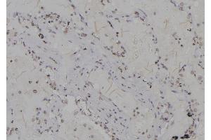 ABIN6266174 and ABIN6277206 at 1/100 staining Human lung tissue by IHC-P.