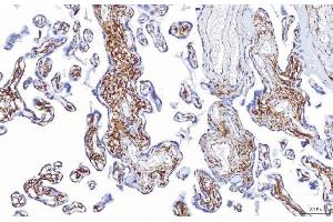 IHC analysis of ENPP1/PC1 using anti-ENPP1/PC1 antibody (ABIN7601410).