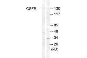 Western Blotting (WB) image for anti-Colony Stimulating Factor 1 Receptor (CSF1R) (Tyr809) antibody (ABIN7179996)