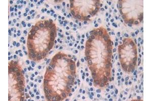 Detection of ADH1 in Human Stomach Tissue using Polyclonal Antibody to Alcohol Dehydrogenase 1 (ADH1) (ADH1 抗体  (AA 169-370))