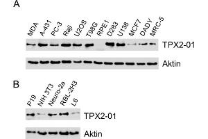 Western blotting analysis of TPX2 using monoclonal antibody TPX2-01 in A) human cell lines, B) murine (P19, NIH 3T3, Neuro-2a) and rat (RBL-2H3, L6) cell lines. (TPX2 抗体)
