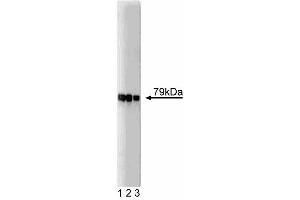 Western blot analysis of AKAP79 on SW13 lysate. (AKAP5 抗体  (AA 180-427))