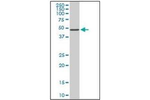 Western Blotting (WB) image for anti-serine/threonine Kinase 38 (STK38) (AA 365-466) antibody (ABIN954986) (STK38 抗体  (AA 365-466))
