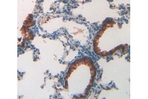 IHC-P analysis of lung tissue, with DAB staining. (MUC5B 抗体  (AA 3667-3771))