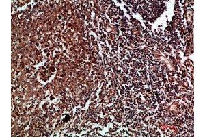 Immunohistochemical analysis of paraffin-embedded human-tonsil, antibody was diluted at 1:200 (CDK6 抗体  (AA 280-325))