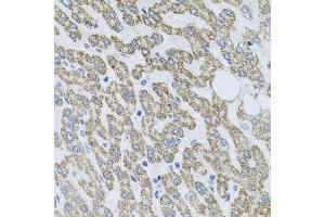Immunohistochemistry of paraffin-embedded human liver injury using NTF4 antibody (ABIN5970439) at dilution of 1/100 (40x lens). (Neurotrophin 4 抗体)