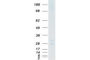 Western Blotting (WB) image for Calcium Channel, Voltage-Dependent, gamma Subunit 6 (CACNG6) (Transcript Variant 1) protein (Myc-DYKDDDDK Tag) (ABIN2713012)