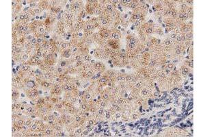 Immunohistochemical staining of paraffin-embedded Human bladder tissue using anti-PECR mouse monoclonal antibody. (PECR 抗体)