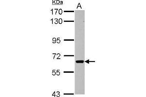 Western Blotting (WB) image for anti-Activin Receptor Type 1C (ACVR1C) (Center) antibody (ABIN2855632)