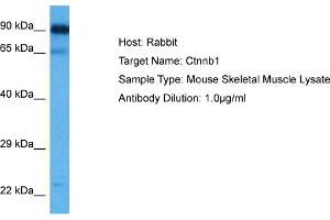 Host:  Rabbit  Target Name:  CTNNB1  Sample Tissue:  Mouse Skeletal Muscle  Antibody Dilution:  1ug/ml