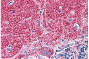 Human Brain, Cerebellum: Formalin-Fixed, Paraffin-Embedded (FFPE) (Septin 3 抗体  (AA 15-26))