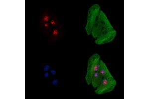 ABIN6261546 and ABIN6278460 staining  cells by IF/ICC. (EOMES 抗体  (C-Term))