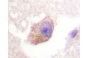 Immunohistochemistry analyzes of TPH1 antibody in paraffin-embedded human brain tissue. (Tryptophan Hydroxylase 1 抗体)