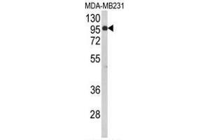 Western blot analysis of BAHD1 Antibody (C-term) in MDA-MB231 cell line lysates (35µg/lane).