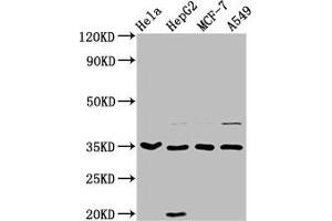 Western Blot Positive WB detected in: Hela whole cell lysate, HepG2 whole cell lysate, MCF-7 whole cell lysate, A549 whole cell lysate All lanes: AIMP1 antibody at 3. (AIMP1 抗体  (AA 25-180))