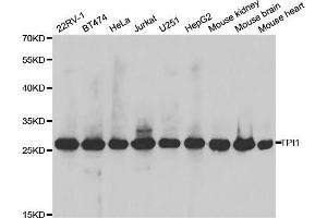 Western blot analysis of extracts of various cell lines, using TPI1 antibody. (TPI1 抗体)