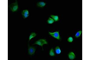 Immunofluorescence staining of MCF-7 cells with ABIN7165166 at 1:166, counter-stained with DAPI. (C19ORF12 抗体  (AA 65-104))