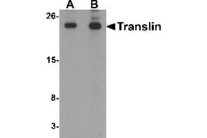 Western blot analysis of Translin in rat lung tissue lysate with Translin antibody at (A) 0.
