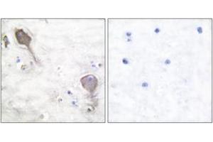 Immunohistochemistry analysis of paraffin-embedded human brain tissue, using Parkin Antibody. (Parkin 抗体  (AA 1-50))