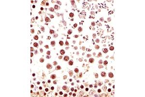 Immunohistochemistry (Paraffin-embedded Sections) (IHC (p)) image for anti-RNA Polymerase-Associated Protein CTR9 Homolog (CTR9) (AA 1022-1056), (C-Term) antibody (ABIN6243851)