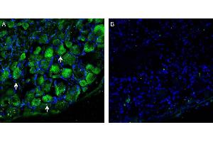 Immunohistochemistry (IHC) image for anti-Solute Carrier Family 7 (Cationic Amino Acid Transporter, Y+ System), Member 5 (SLC7A5) (AA 222-235) antibody (ABIN7043750)