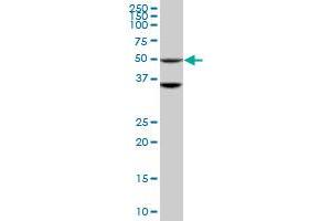 Western Blotting (WB) image for anti-serine/threonine Kinase 40 (STK40) (AA 349-435) antibody (ABIN599597) (STK40 抗体  (AA 349-435))