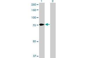 Western Blotting (WB) image for anti-Proprotein Convertase Subtilisin/kexin Type 2 (PCSK2) (AA 1-638) antibody (ABIN518705)