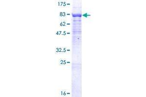 BTBD9 Protein (AA 1-582) (GST tag)