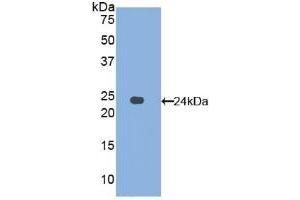 Detection of Recombinant AFM, Human using Polyclonal Antibody to Afamin (AFM) (Afamin 抗体  (AA 211-403))