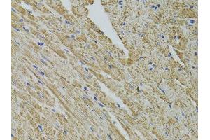 Immunohistochemistry (Paraffin-embedded Sections) (IHC (p)) image for anti-Fragile Histidine Triad (FHIT) (AA 25-147) antibody (ABIN3021692)