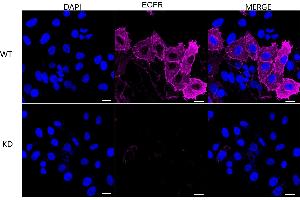 Immunocytochemical staining of HepG2 cells using EGFR antibody (ABIN7798480), 1:1,000), Top panel: wild-type (WT), Bottom panal: Adiponectin receptor 1 shRNA knockdown (KD). (Recombinant EGFR 抗体)