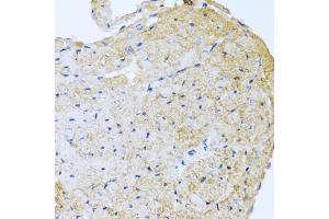 Immunohistochemistry of paraffin-embedded mouse heart using STC1 antibody (ABIN5975425) at dilution of 1/100 (40x lens). (Stanniocalcin 1 抗体)