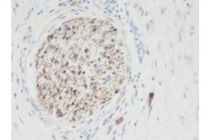 Image no. 1 for anti-Galectin 3 (LGALS3) antibody (ABIN464873) (Galectin 3 抗体)