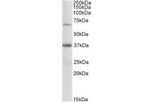 Image no. 1 for anti-Carnitine Palmitoyltransferase 2 (CPT2) (Internal Region) antibody (ABIN487977) (CPT2 抗体  (Internal Region))