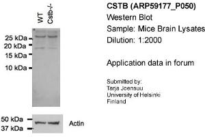 Western Blotting (WB) image for anti-Cystatin B (Stefin B) (CSTB) (N-Term) antibody (ABIN2787965) (CSTB 抗体  (N-Term))