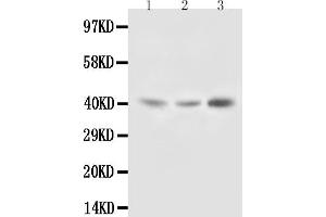 Anti-Decorin antibody, Western blotting Lane 1: Rat Liver Tissue Lysate Lane 2: Rat Kidney Tissue Lysate Lane 3: SMMC Cell Lysate (Decorin 抗体  (C-Term))