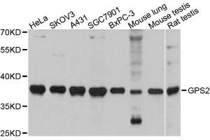 Western blot analysis of extracts of various cell lines, using GPS2 antibody (ABIN5972076) at 1:3000 dilution. (GPS2 抗体)