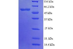 SDS-PAGE (SDS) image for PYD (Pyrin Domain) Containing 1 (PYDC1) (AA 18-470) protein (His tag) (ABIN5710764) (PYDC1 Protein (AA 18-470) (His tag))