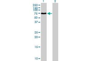 Western Blot analysis of SOCS6 expression in transfected 293T cell line by SOCS6 MaxPab polyclonal antibody. (SOCS6 抗体  (AA 1-535))