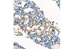 Immunohistochemistry of paraffin embedded mouse bone using CSF1 (ABIN7073553) at dilution of 1:450 (400x lens) (M-CSF/CSF1 抗体)