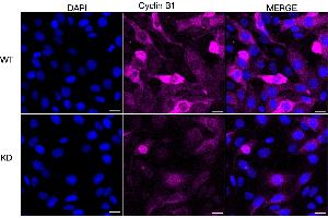 Immunocytochemical staining of HT cells using Cyclin B1 antibody (ABIN7798189), 1:1,000), Top panel: wild-type (WT), Bottom panal: Cyclin B1 shRNA knockdown (KD). (Recombinant Cyclin B1 抗体)