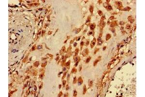 Immunohistochemistry of paraffin-embedded human placenta tissue using ABIN7163206 at dilution of 1:100 (PIGA 抗体  (AA 443-484))