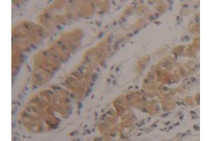 DAB staining on IHC-P; Samples: Human Stomach Tissue (SUOX 抗体  (AA 80-545))