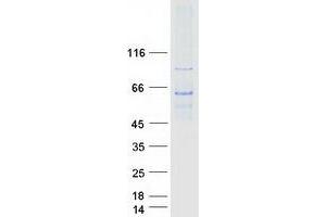 GHDC Protein (Transcript Variant 1) (Myc-DYKDDDDK Tag)