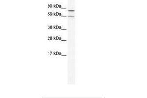 Image no. 1 for anti-Poly A Specific Ribonuclease (PARN) (N-Term) antibody (ABIN202834) (PARN 抗体  (N-Term))