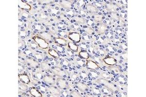 Immunohistochemistry (Paraffin-embedded Sections) (IHC (p)) image for anti-Solute Carrier Family 6 (Neurotransmitter Transporter, Creatine), Member 8 (SLC6A8) antibody (ABIN7075678)